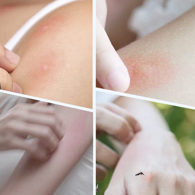 Ultrasonic powerful mosquito repellent wristband - Image 2